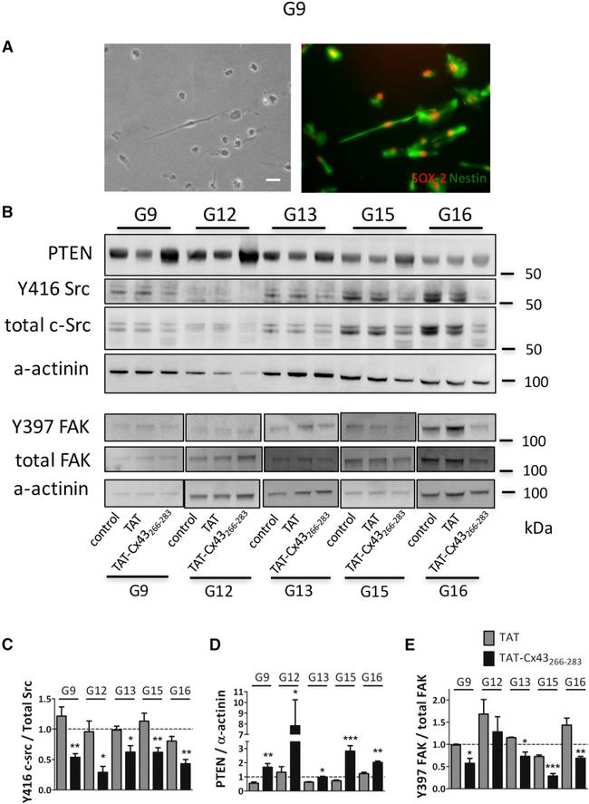 FAK Antibody in Western Blot (WB)