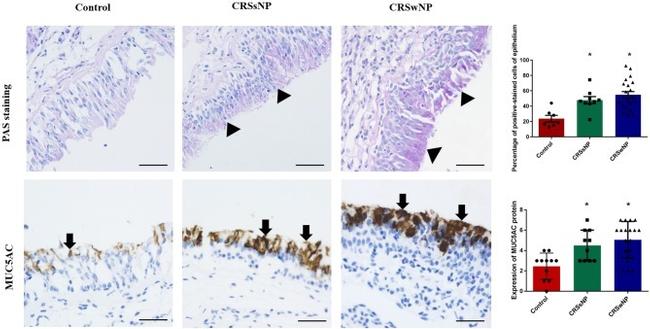 MUC5AC Antibody in Immunohistochemistry (IHC)