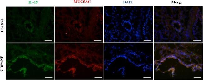 MUC5AC Antibody in Immunohistochemistry (IHC)