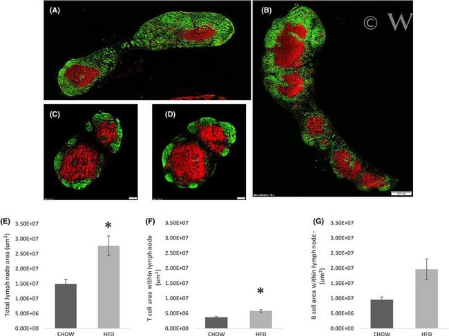 CD3 Antibody in Immunocytochemistry (ICC/IF)