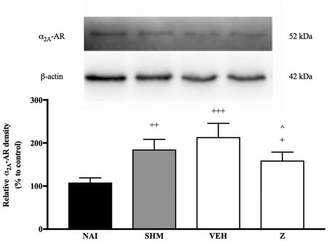 alpha-2a Adrenergic Receptor Antibody in Western Blot (WB)