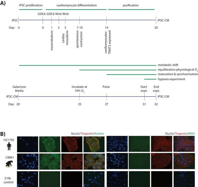 Cardiac Troponin T Antibody in Immunocytochemistry, Immunohistochemistry (ICC/IF, IHC)