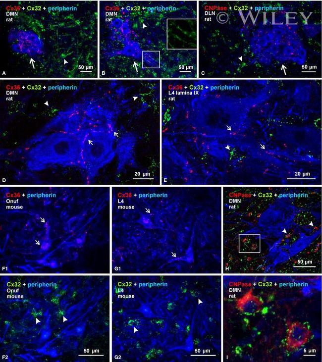 Connexin 32 Antibody in Immunohistochemistry (IHC)