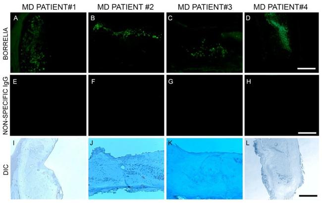 Borrelia burgdorferi Antibody in Immunohistochemistry (IHC)