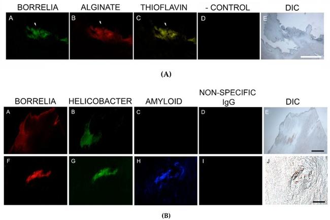 Helicobacter pylori Antibody in Immunohistochemistry (IHC)