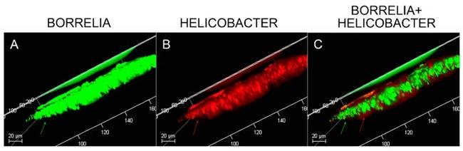 Helicobacter pylori Antibody in Immunocytochemistry, Immunohistochemistry (ICC/IF, IHC)