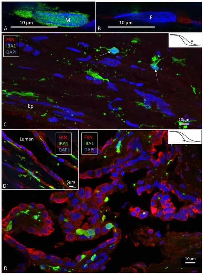 IBA1 Antibody in Immunocytochemistry, Immunohistochemistry (ICC/IF, IHC)