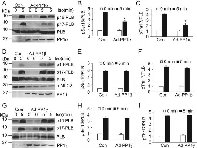 Phospholamban Antibody in Western Blot (WB)