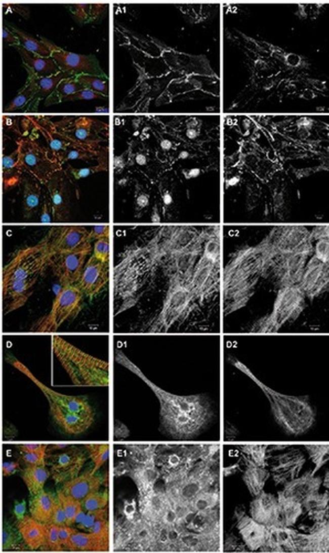 beta Catenin Antibody in Immunocytochemistry, Immunohistochemistry (ICC/IF, IHC)