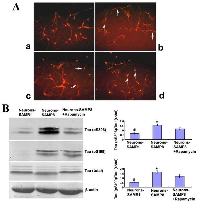 Phospho-Tau (Ser199) Antibody in Western Blot (WB)