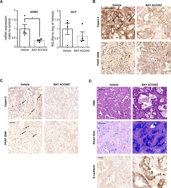 E-cadherin Antibody in Immunohistochemistry (IHC)