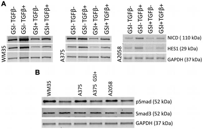 NOTCH1 Antibody in Western Blot (WB)