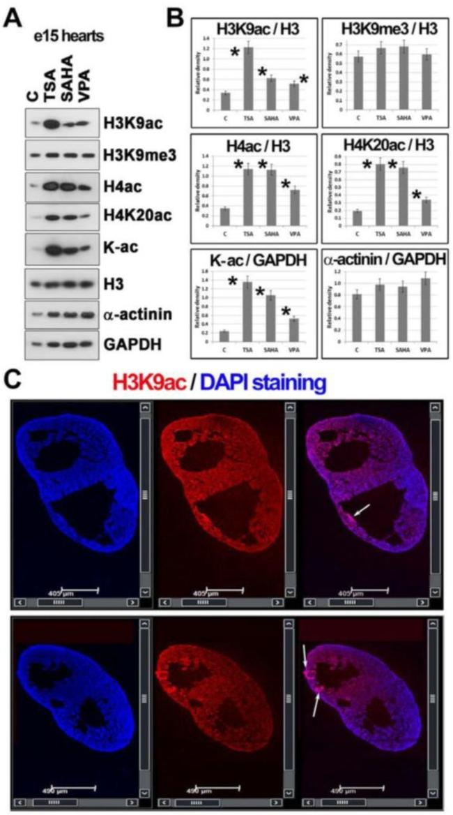 H4K20ac Antibody