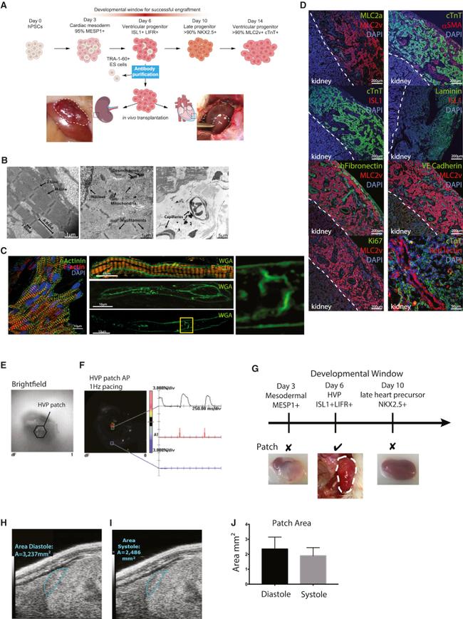 Alpha-Smooth Muscle Actin Antibody in Immunohistochemistry (IHC)