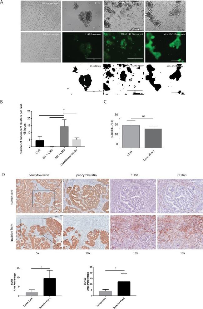 Cytokeratin Pan Type I/II Antibody in Immunohistochemistry (IHC)