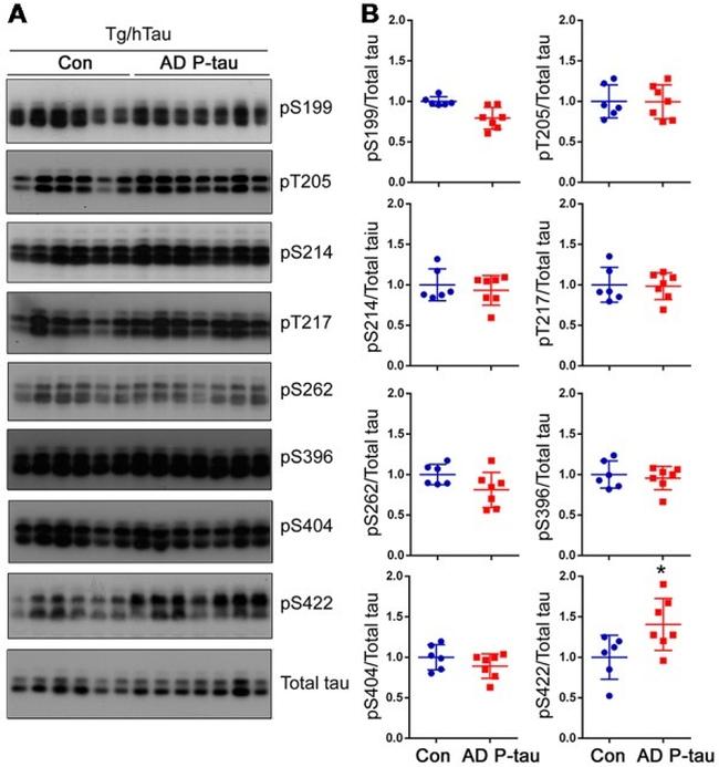 Phospho-Tau (Ser396) Antibody in Western Blot (WB)