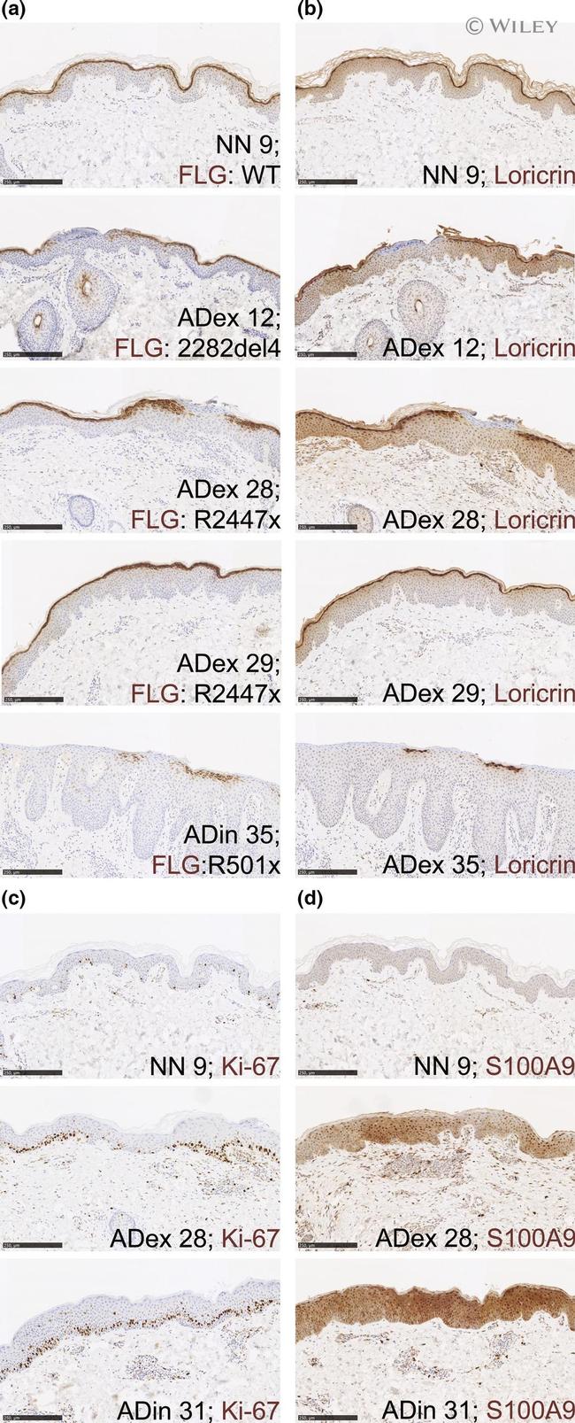 S100A9 Antibody in Immunohistochemistry (IHC)