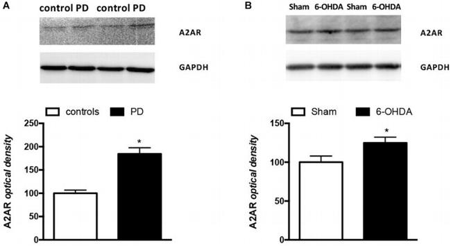 ADORA2A Antibody in Western Blot (WB)