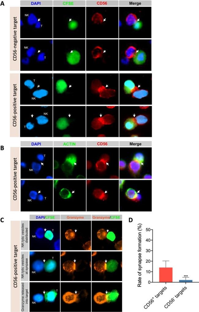 Granzyme B Antibody in Immunocytochemistry (ICC/IF)