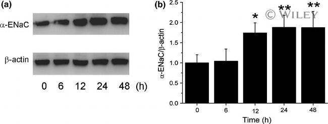 alpha-ENaC Antibody in Western Blot (WB)