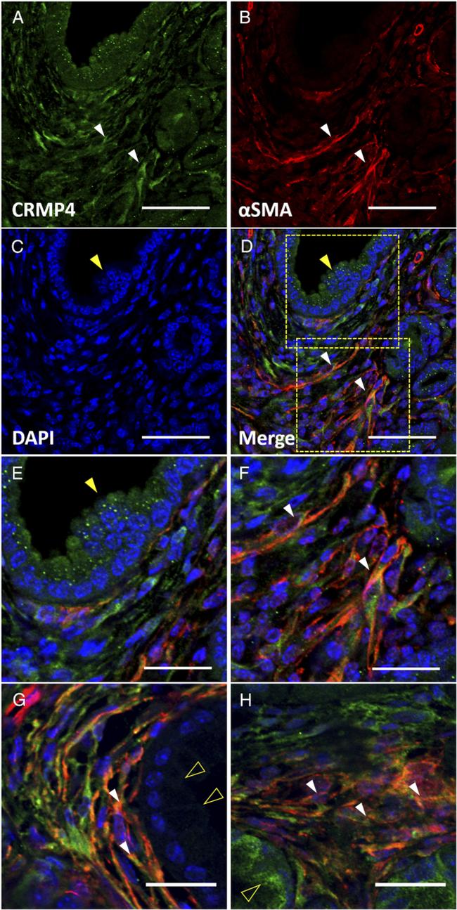 Alpha-Smooth Muscle Actin Antibody in Immunohistochemistry (IHC)