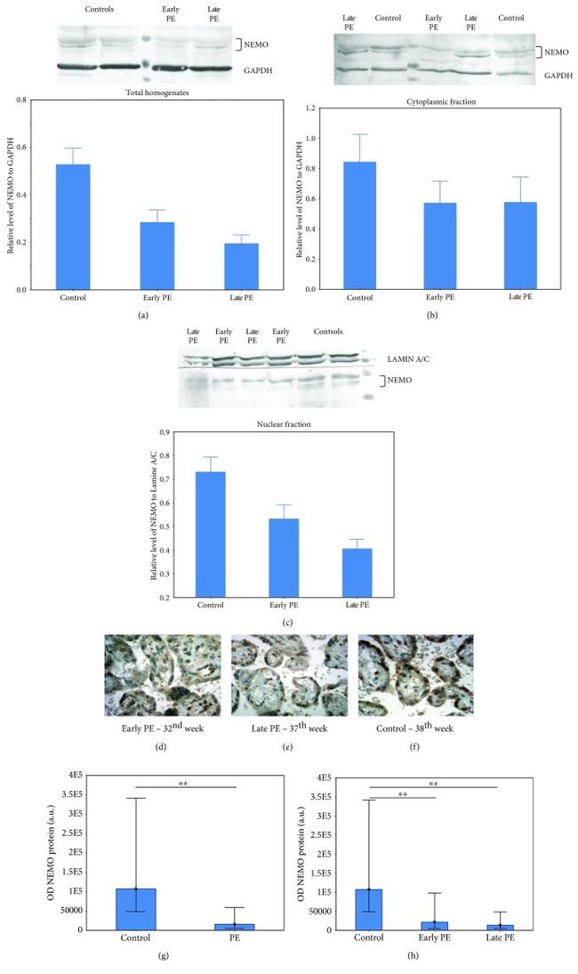 IKK gamma Antibody in Western Blot, Immunohistochemistry (WB, IHC)