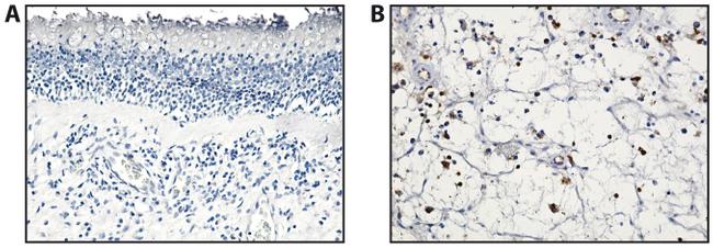 CD3 Antibody in Immunohistochemistry (IHC)