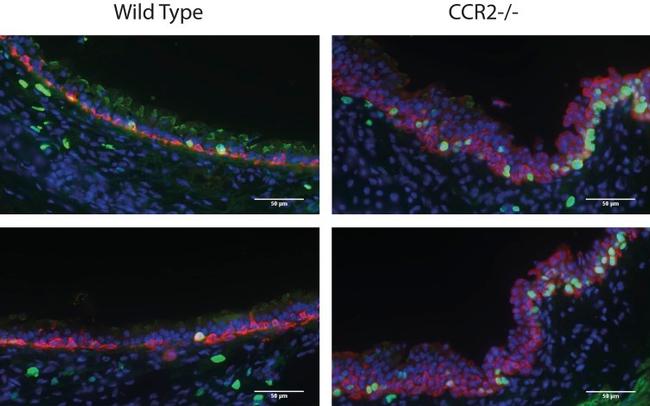 Ki-67 Antibody in Immunohistochemistry, Immunohistochemistry (Paraffin) (IHC, IHC (P))