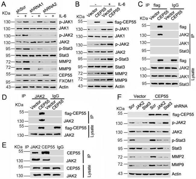 JAK2 Antibody in Western Blot, Immunoprecipitation (WB, IP)