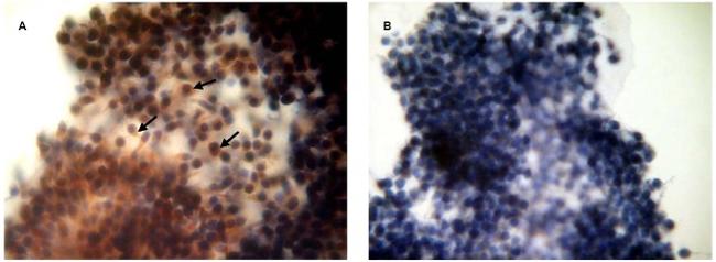 Prolactin Receptor Antibody in Immunocytochemistry, Immunohistochemistry (ICC/IF, IHC)