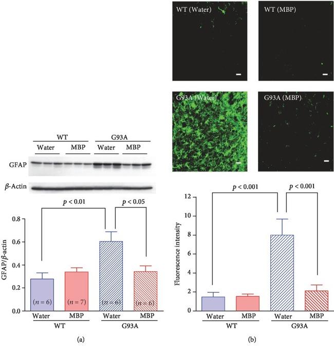 GFAP Antibody in Immunocytochemistry (ICC/IF)