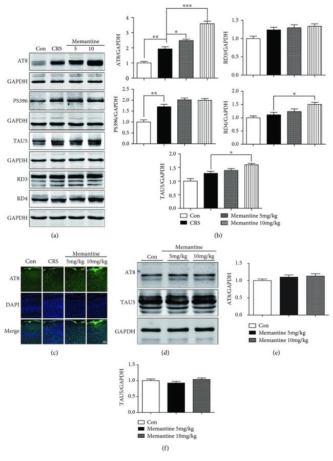 Phospho-Tau (Ser396) Antibody in Western Blot (WB)