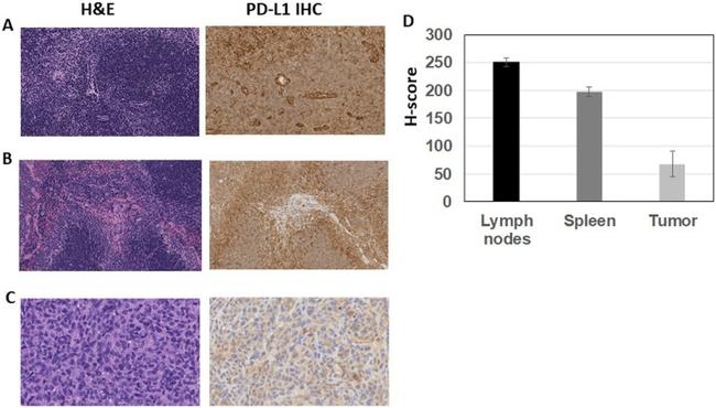 PD-L1 Antibody in Immunohistochemistry (IHC)