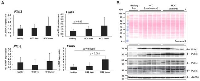 OXPAT Antibody in Western Blot (WB)