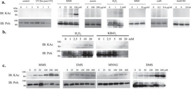 Acetylated Lysine Antibody in Western Blot (WB)