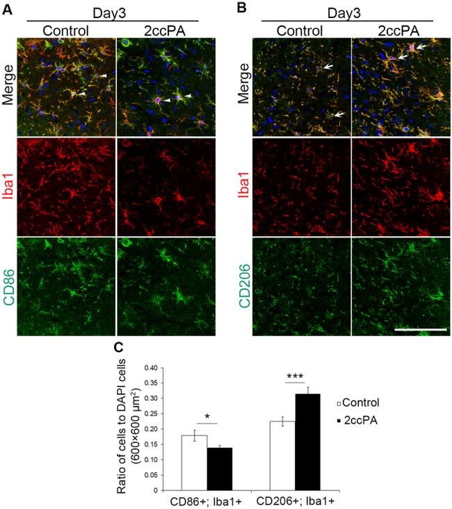 CD86 (B7-2) Antibody in Immunohistochemistry (IHC)