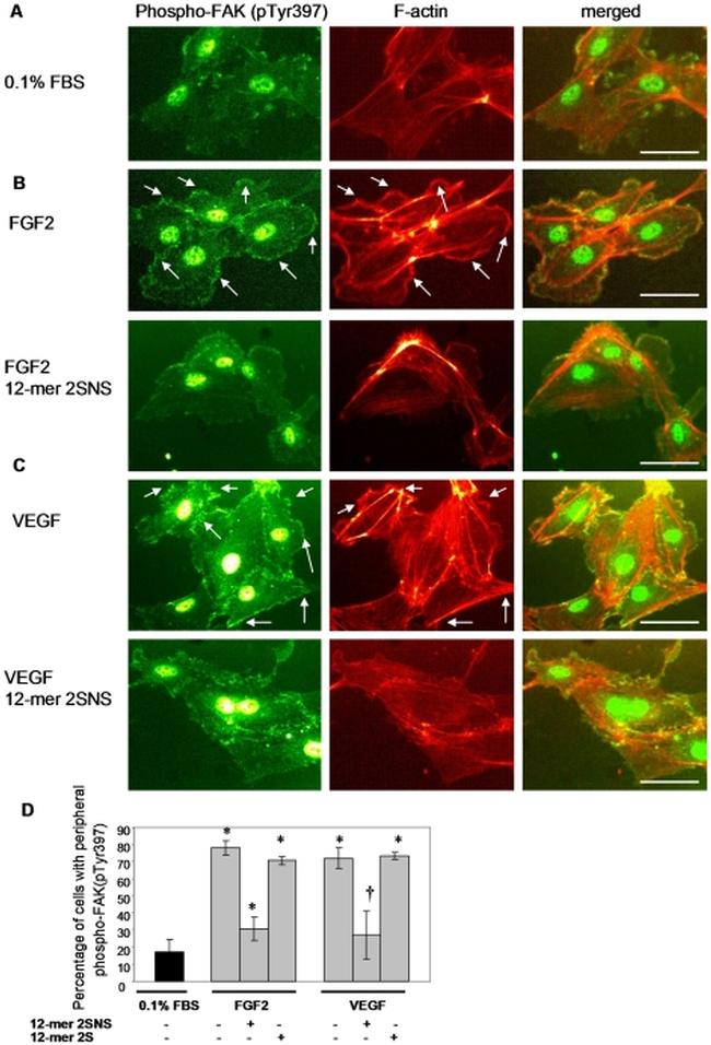 Phospho-VEGF Receptor 2 (Tyr1214) Antibody in Immunocytochemistry (ICC/IF)