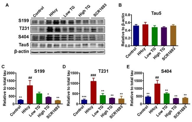 Phospho-Tau (Ser199) Antibody in Western Blot (WB)