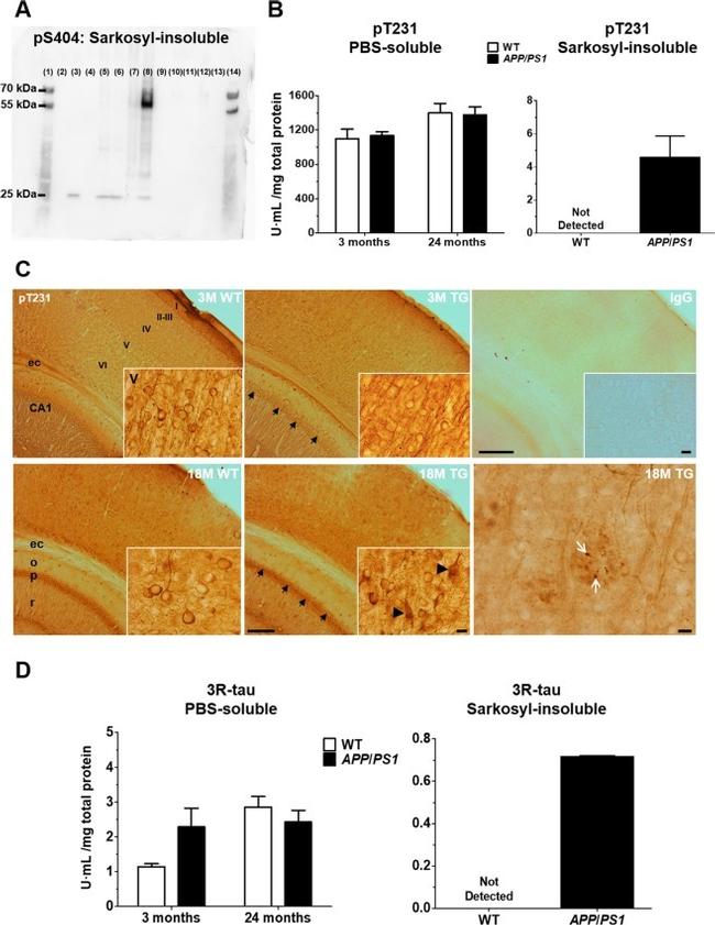 Phospho-Tau (Thr231) Antibody in Immunohistochemistry, ELISA (IHC, ELISA)