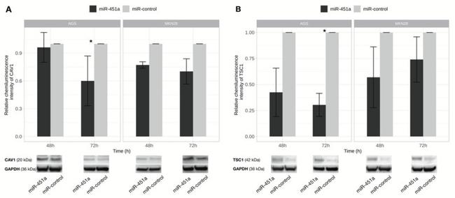 TSC1 Antibody in Western Blot (WB)