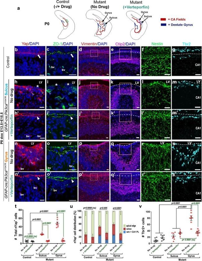 ZO-1 Antibody in Immunohistochemistry (IHC)