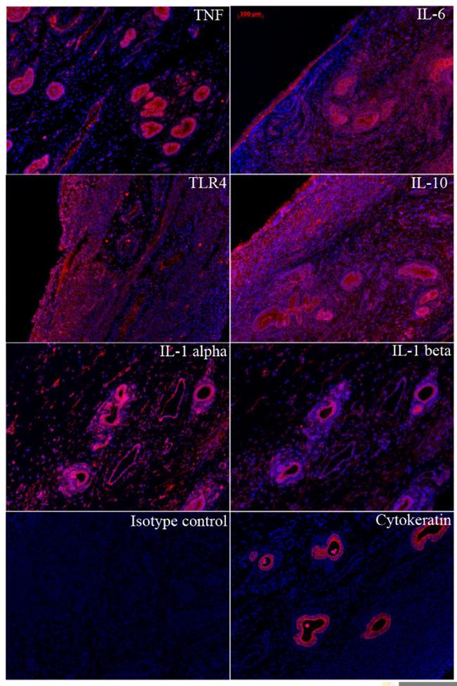 IL-1 alpha Antibody in Immunohistochemistry (IHC)