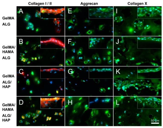 Collagen X Antibody in Immunocytochemistry, Immunohistochemistry (ICC/IF, IHC)