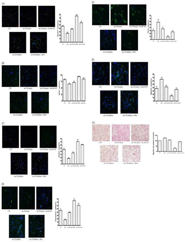 SOX2 Antibody in Immunocytochemistry, Immunohistochemistry (ICC/IF, IHC)