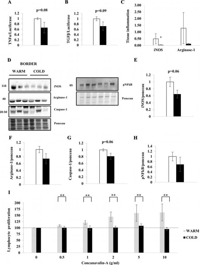 Caspase 1 Antibody in Western Blot (WB)