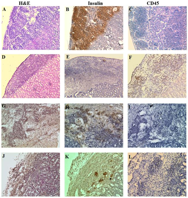 CD45 Antibody in Immunohistochemistry (IHC)