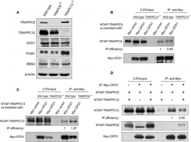 TRAPPC8 Antibody in Western Blot (WB)