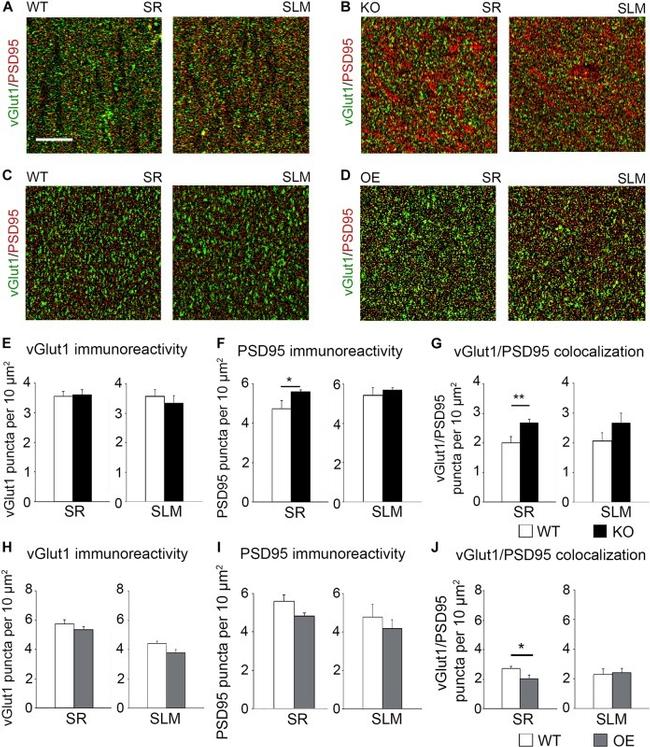 VGLUT1 Antibody in Immunohistochemistry (IHC)