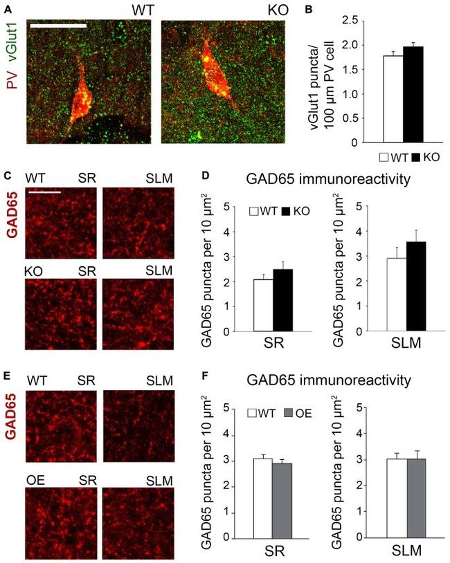 VGLUT1 Antibody in Immunohistochemistry (IHC)