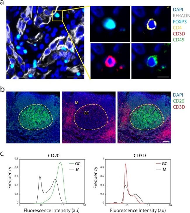 FOXP3 Antibody in Immunohistochemistry (IHC)